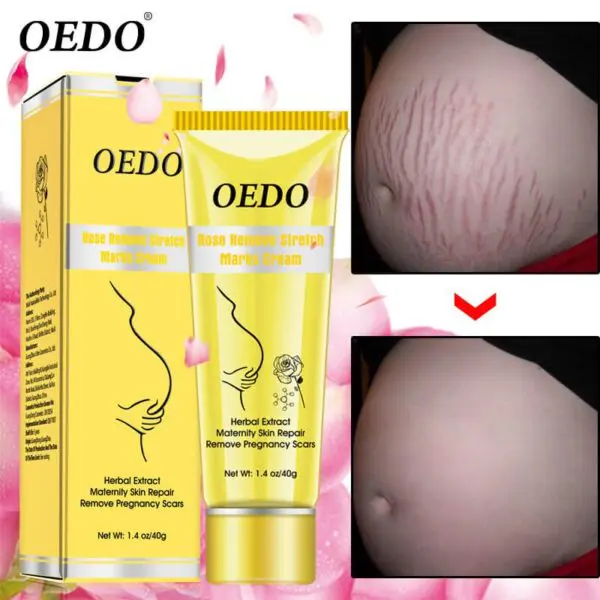 Natural Organic Stretchmarkls Removal Cream Anti Wrinkle, Anti Aging, Anti Stretch Marks Cream
