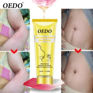 Natural Organic Stretchmarkls Removal Cream Anti Wrinkle, Anti Aging, Anti Stretch Marks Cream