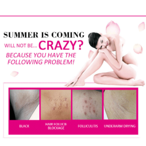 Private Parts Whitening Cream For Body, Armpit ,Legs and Knees.